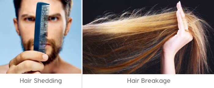 Hair-shedding-hair-breakage