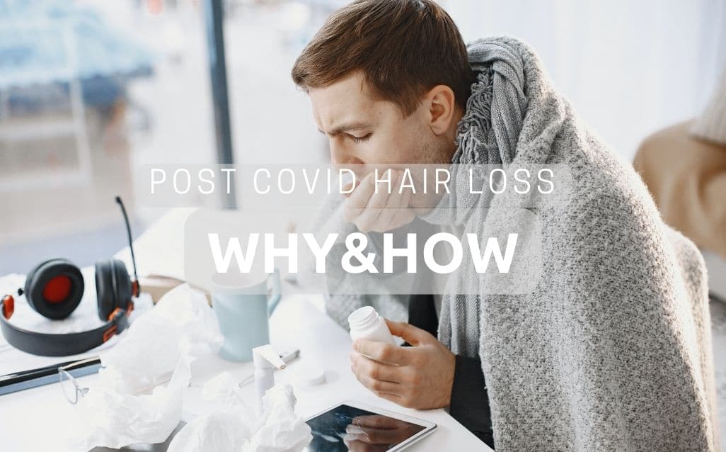 Why-Does-COVID-19-Cause-Hair-Loss-and-How-to-Deal-With-It