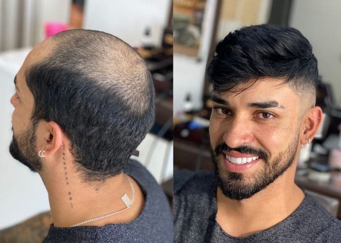 This Guy Tested Hair Fibers to Try and Cover Up His Bald Spot