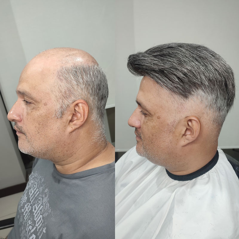 HS1V C1A50 hair system before and after