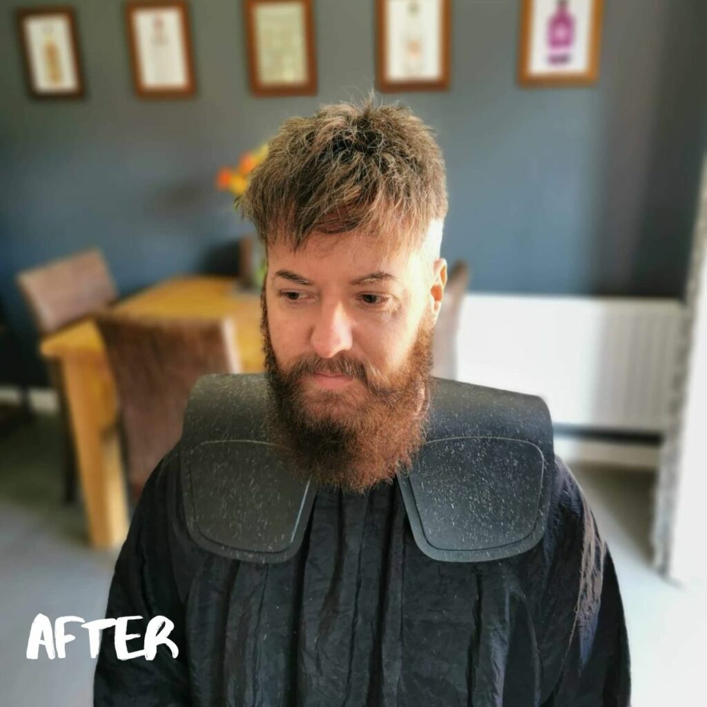 after-wearing-a-hair-system-before-and-after-1