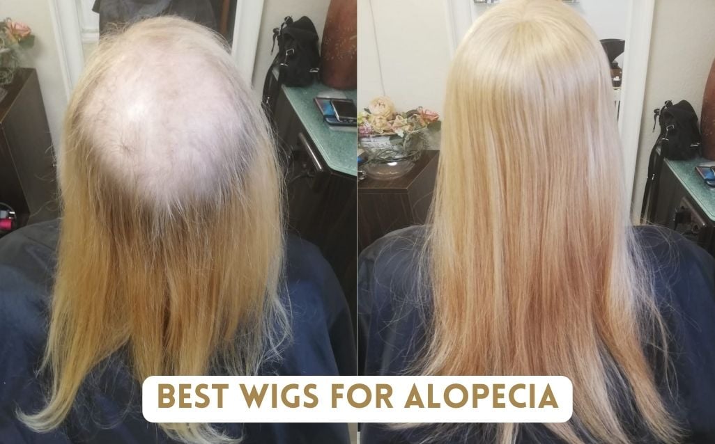 best-wigs-for-alopecia