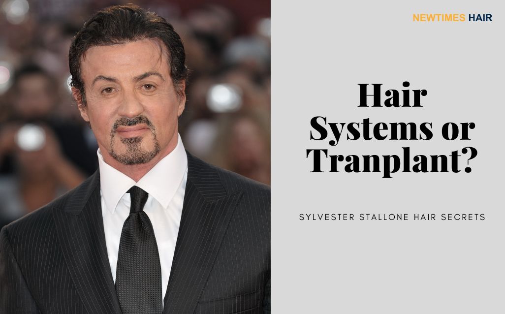 Sylvester Stallone Hair Secrets a Toupee or Transplant